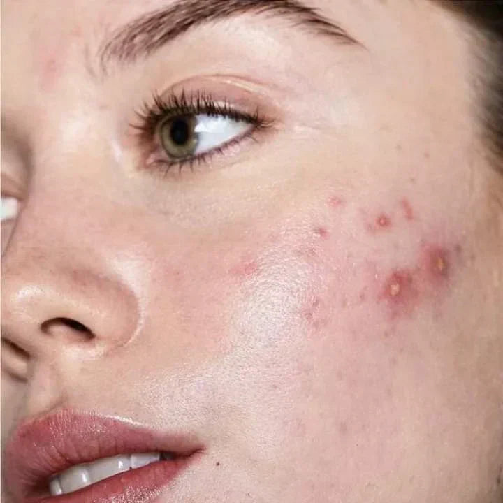 Biofilm On Your Face: What It Is and Why Your Skincare Can't Reach It