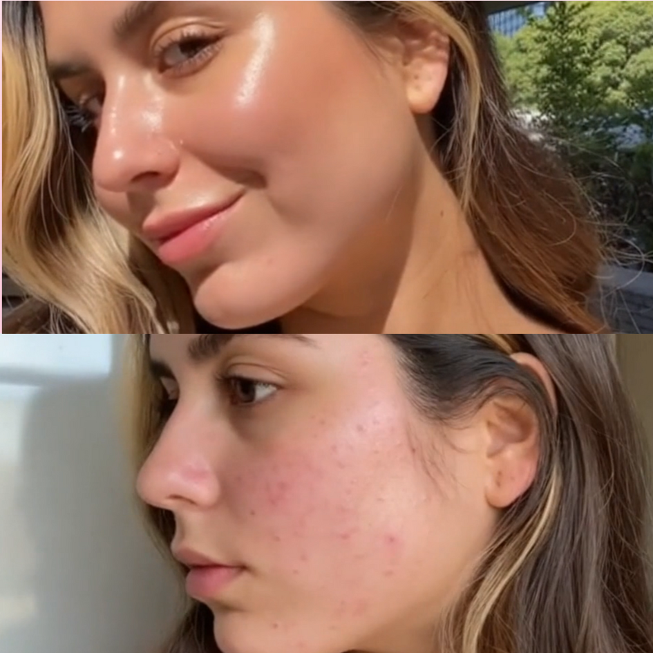 Biofilm In Skincare: How Does It Affect My Skin?